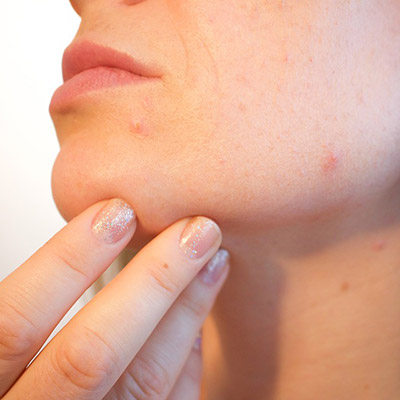dermatology tipton compounding pharmacy
